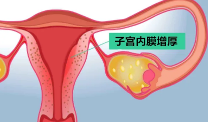 哪些人群適合養(yǎng)囊？ 有哪些原因