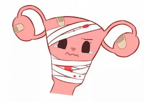 疤痕子宮也可以剖腹產(chǎn)生小孩，但產(chǎn)前這些事項和風險要先了解清楚