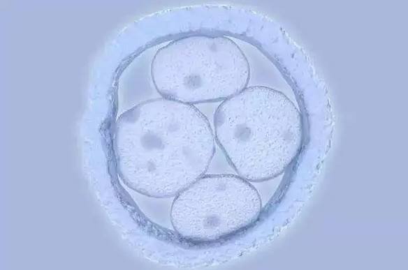 囊胚培育長的慢怎么辦？不同原因解決方法不一樣