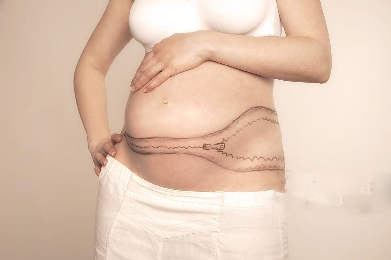 你適合生第**嗎？