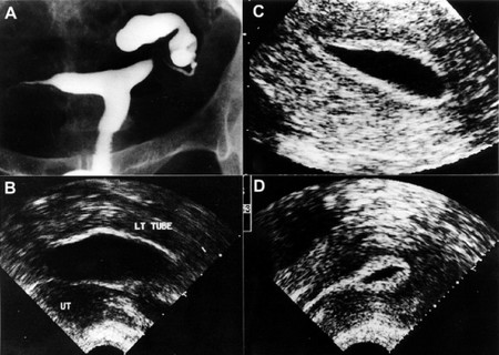 如何自我檢查不孕，可以看完這些步驟！