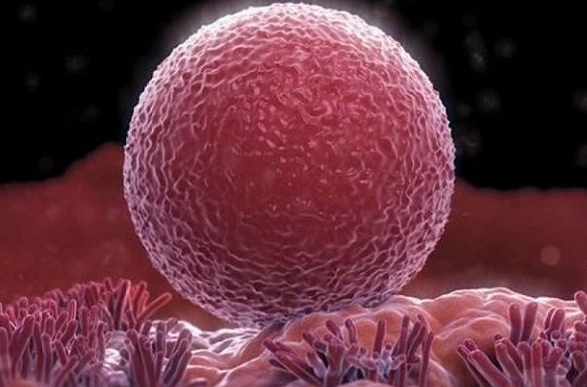 孕15周還吐是怎么回事？會(huì)不會(huì)影響胎兒？