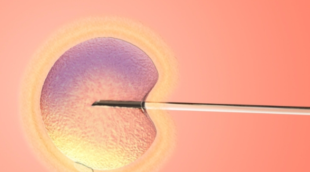 高齡必須做三代試管的理由都有哪些？