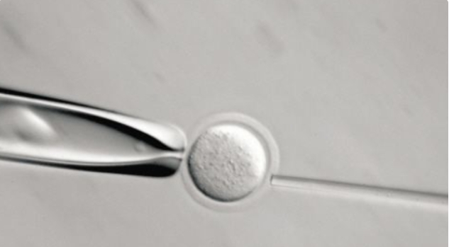 高齡做試管嬰兒怎么提高一次試管成功幾率呢？