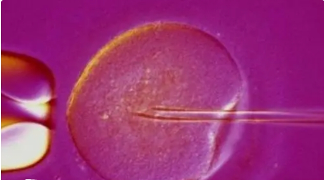 高齡做試管嬰兒的話大概能有多少成功率呢？