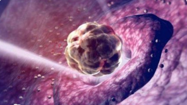 高齡做試管嬰兒發(fā)現(xiàn)卵泡比較少影響大嗎？