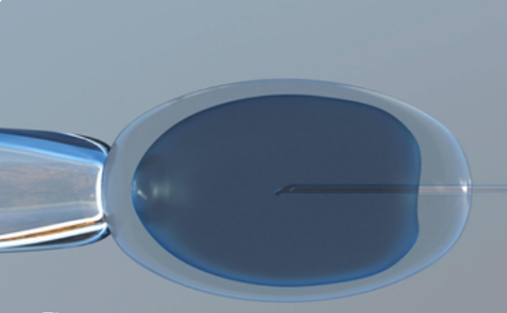 高齡女性去做試管嬰兒失敗幾率是不是很高？