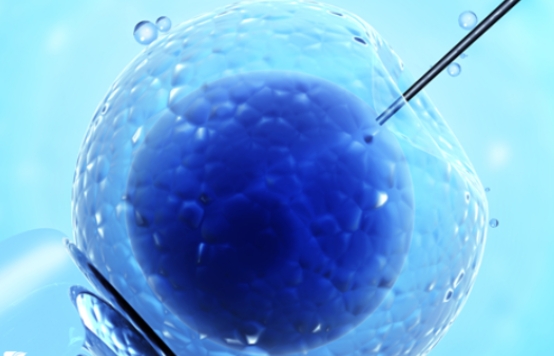  三代試管可以排除掉唐氏綜合征的基因嗎？