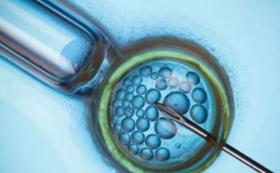 做試管嬰兒**的幾率高不高？