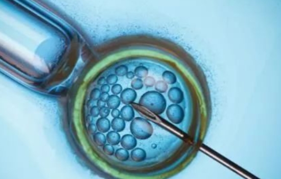 高齡女性做試管嬰兒去公立醫(yī)院好還是私立呢？