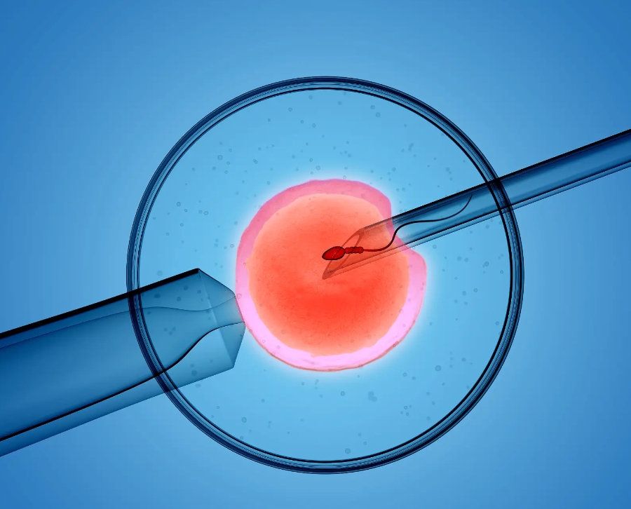  高齡做試管嬰兒的費用一般要多少錢？