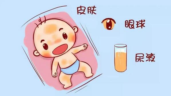 十個(gè)寶寶九個(gè)黃，可能跟寶媽孕期的習(xí)慣有關(guān)系！