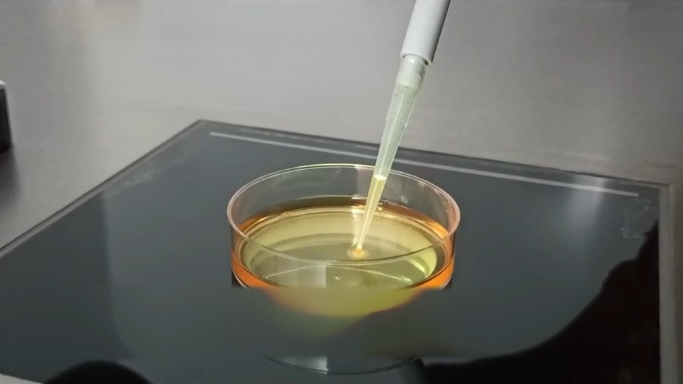 做完試管嬰兒手術(shù)后能獻(xiàn)血嗎？