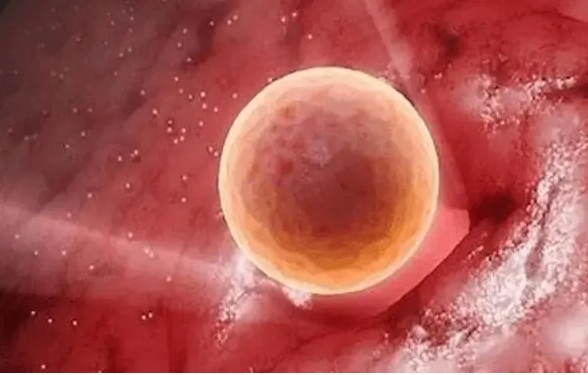 做三代試管需要同時移植兩個胚胎嗎？