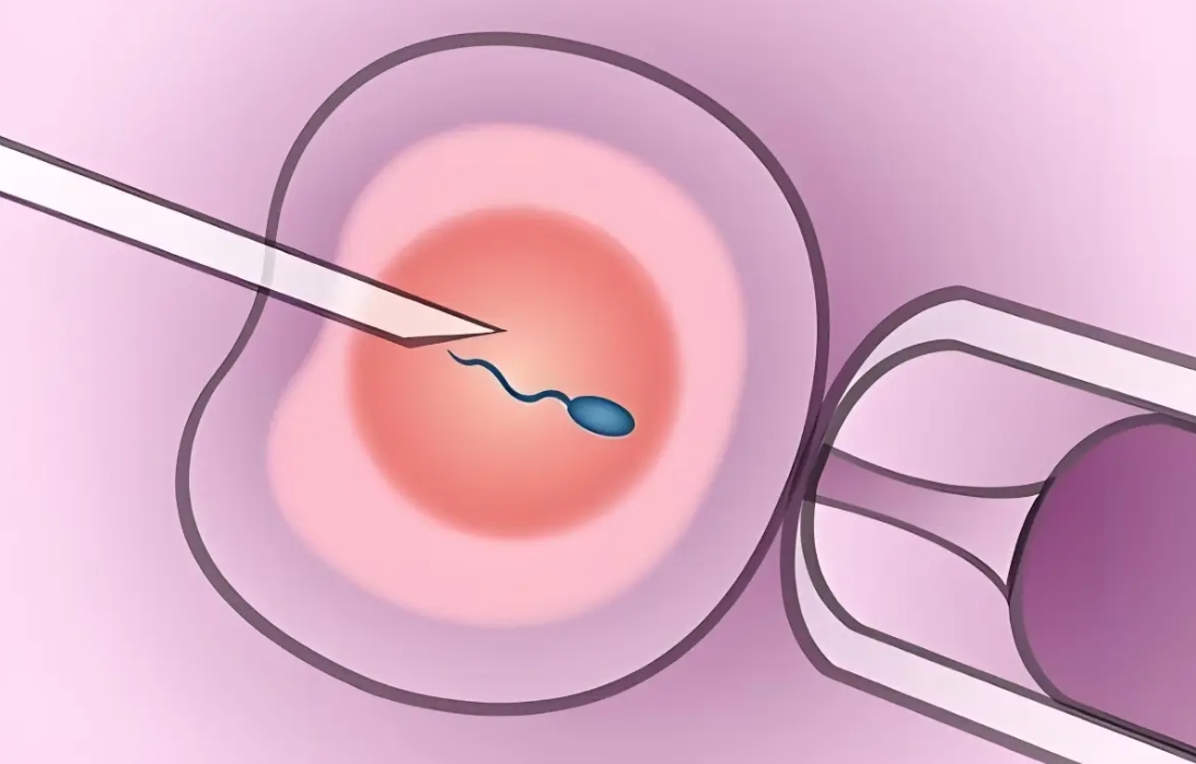 為什么要在睡前服用溴隱亭？