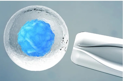 做試管**不打麻藥會很疼嗎？