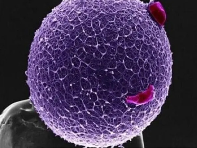 多囊卵巢綜合癥是什么原因?qū)е碌模? /></div>
					</div>
					<div   id=