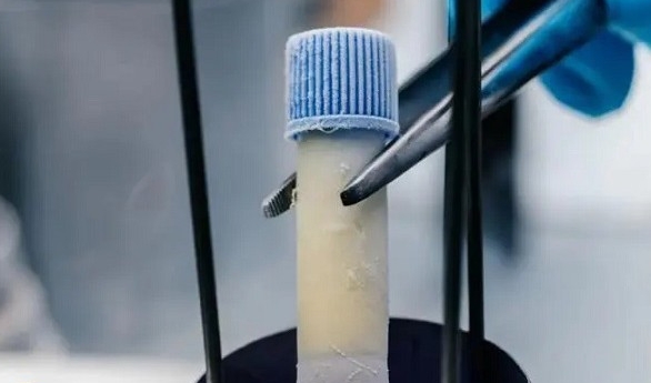 在赤峰做試管嬰兒的花費(fèi)是多少錢？