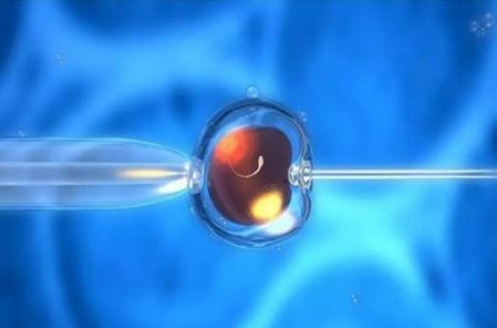 試管嬰兒自然周期方案的注意事項是什么？