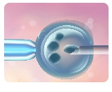 促排前需要做大卵泡穿刺嗎？這樣做有哪些優(yōu)點？