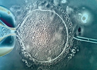 什么是宮腔鏡？宮腔鏡有哪些作用？做揭陽試管嬰兒必須要做宮腔鏡嗎?