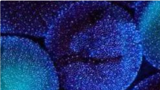 高齡做試管嬰兒需要注意哪幾個地方？