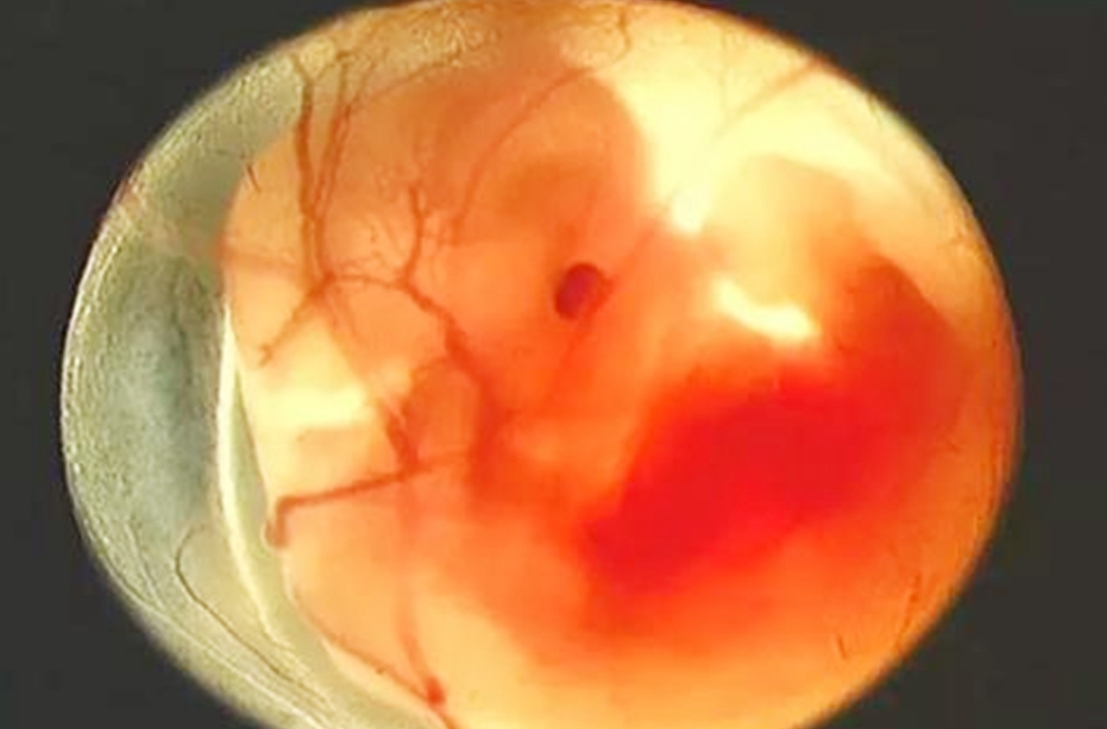  試管嬰兒促排長方案是什么？有什么作用？