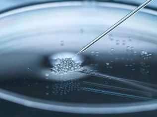 進口干細胞治療眼袋效果好嗎？真實案例分享！