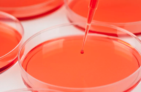 干細胞移植治療腎癌需要多少費用？成功率如何？