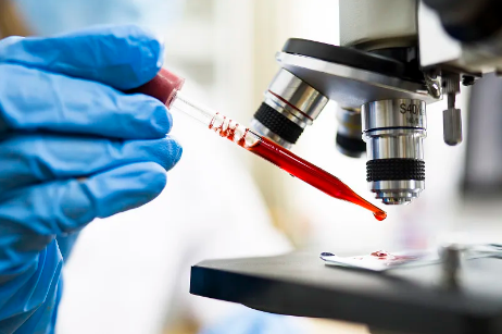 干細胞移植治療白血病效果如何？如何選擇最佳干細胞移植醫(yī)院？