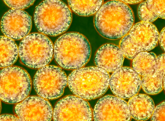 干細胞療法如何改善疾病癥狀？它的具體功效有哪些？