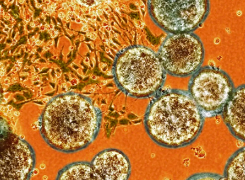 魏則西事件中干細(xì)胞治療法是什么？