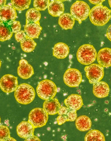 深圳哪家干細(xì)胞機(jī)構(gòu)口碑比較好？哪家值得推薦？