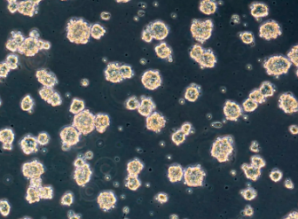 造血干細(xì)胞移植哪家醫(yī)院好？如何提高移植成功率？