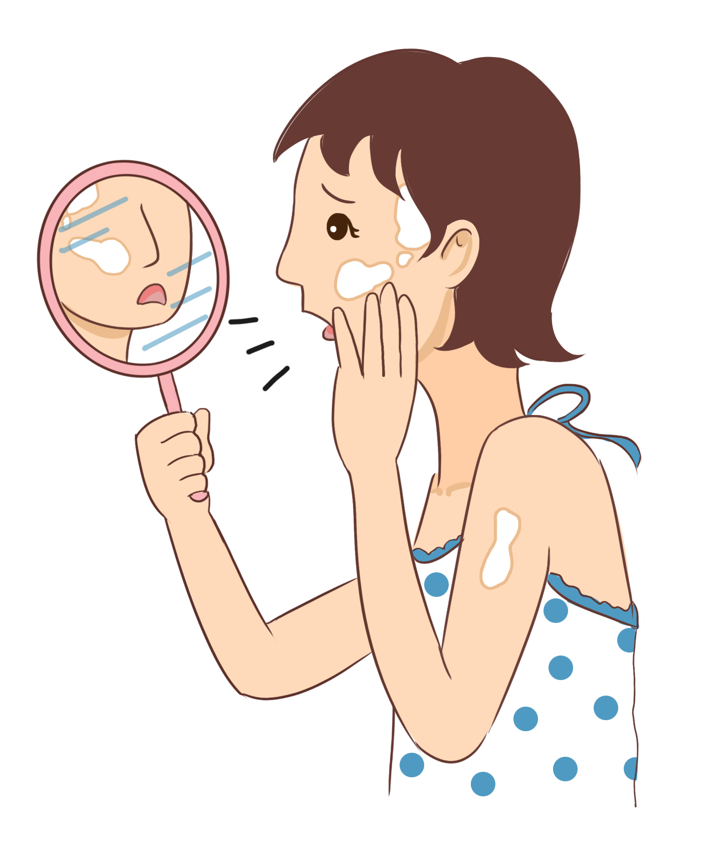 白癜風(fēng)有效的治療方法是什么