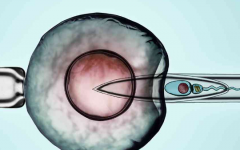 昆明送子鳥試管費用是多少