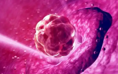 試管是怎么移植到子宮的