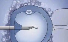 安順市試管助孕中心試管嬰兒費(fèi)用