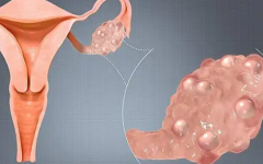 卵巢早衰做試管一般幾次成功
