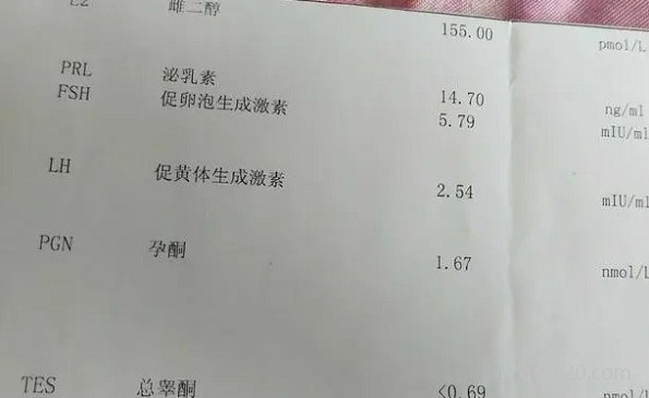 fsh和amh哪個(gè)更重要