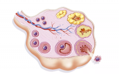 有排卵障礙能做試管嬰兒嗎