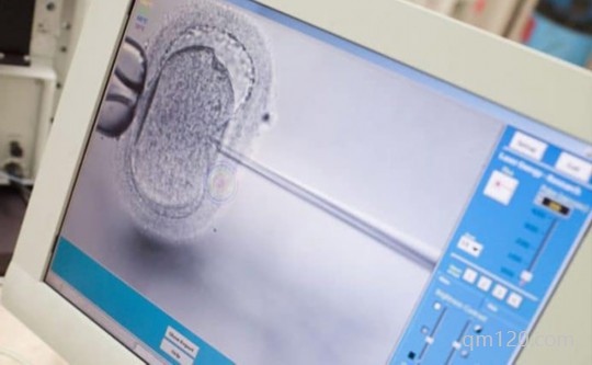 第二代試管嬰兒