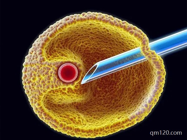 試管促排卵打麻藥和不打麻藥的區(qū)別