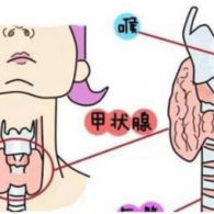 甲狀腺功能異常