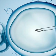 第三代試管嬰兒