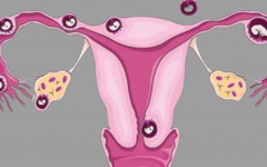 雙側(cè)輸卵管切除能做試管嗎