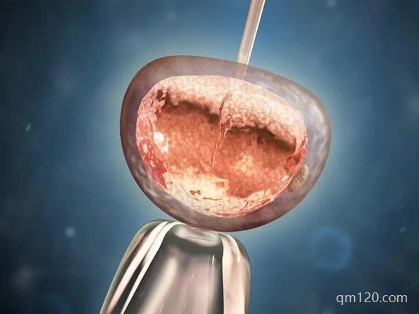 女人做了試管人就廢了