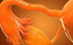 卵巢早衰做試管成功率高嗎