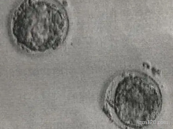 移植鮮胚不好么