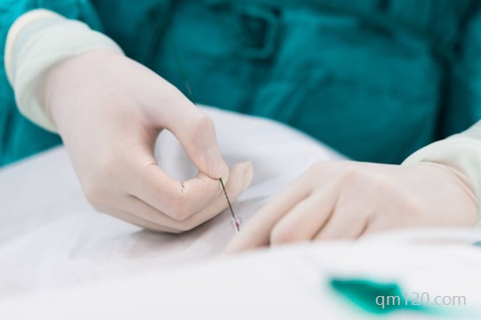 試管促排卵泡不圓怎么辦